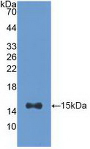 Polyclonal Antibody to Aconitase 1 (ACO1)