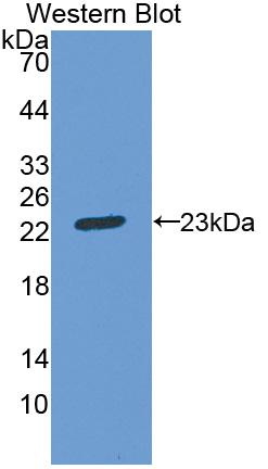 Polyclonal Antibody to Aconitase 1 (ACO1)