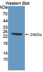 Polyclonal Antibody to Abl Interactor 1 (ABI1)