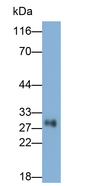 Polyclonal Antibody to Succinate Dehydrogenase Complex Subunit B (SDHB)