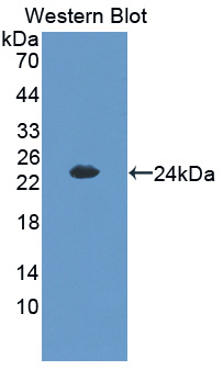 PAJ771Hu01.jpg