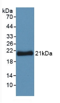 Polyclonal Antibody to Tyrosine 3/Tryptophan 5 Monooxygenase Activation Protein Zeta (YWHAz)