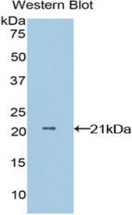 Polyclonal Antibody to Non Metastatic Cells 1, Protein NM23A Expressed In (NME1)