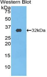Polyclonal Antibody to Phosphoinositide-3-Kinase Class-2-Beta Polypeptide (PIK3C2b)