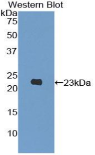 Polyclonal Antibody to Phosphoinositide-3-Kinase Catalytic Beta Polypeptide (PIK3Cb)