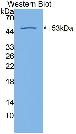 Polyclonal Antibody to Retinoschisin (RS)