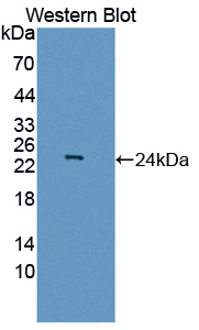 Polyclonal Antibody to Achaete Scute Complex Like Protein 1 (ASCL1)