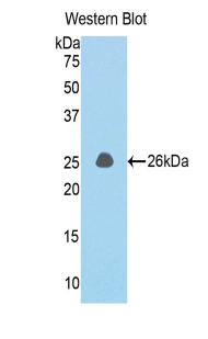 Polyclonal Antibody to Coiled Coil Domain Containing Protein 80 (CCDC80)