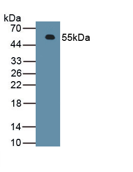 Polyclonal Antibody to Fragile X Mental Retardation Syndrome Related Protein 1 (FXR1)