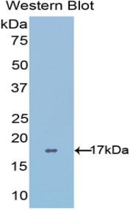 Polyclonal Antibody to A Disintegrin And Metalloproteinase With Thrombospondin 4 (ADAMTS4)