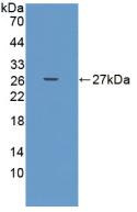 Polyclonal Antibody to A Disintegrin And Metalloproteinase With Thrombospondin 9 (ADAMTS9)