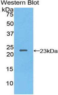 Polyclonal Antibody to Non Metastatic Cells 3, Protein NM23A Expressed In (NME3)