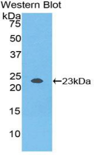 Polyclonal Antibody to Non Metastatic Cells 3, Protein NM23A Expressed In (NME3)