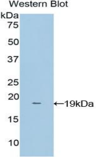 Polyclonal Antibody to Non Metastatic Cells 4, Protein NM23A Expressed In (NME4)