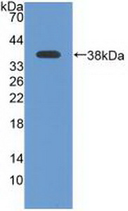Polyclonal Antibody to Ataxia Telangiectasia And Rad3 Related Protein (ATR)