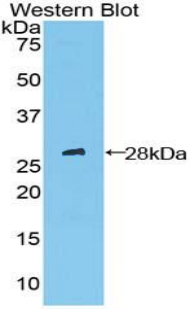 Polyclonal Antibody to Patched Homolog 1 (PTCH1)