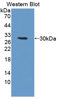 Polyclonal Antibody to Protein Kinase, DNA Activated, Catalytic Polypeptide (PRKDC)