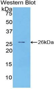 Polyclonal Antibody to Pentraxin 3, Long (PTX3)