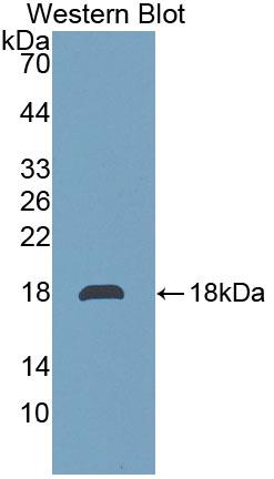 Polyclonal Antibody to Transmembrane Protein 27 (TMEM27)