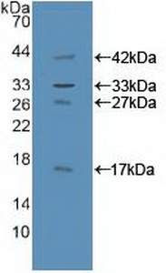 Polyclonal Antibody to GRB2 Associated Binding Protein 1 (GAB1)