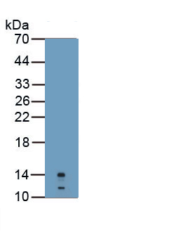 Polyclonal Antibody to Calprotectin (CALPRO)