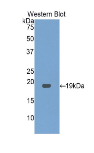 Polyclonal Antibody to Gastrokine 3 (GKN3)