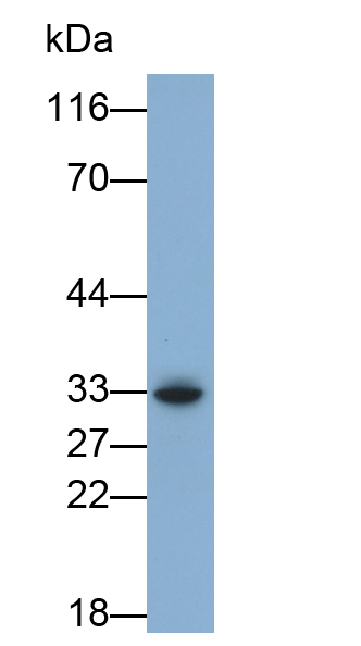 Polyclonal Antibody to PTEN Induced Putative Kinase 1 (PINK1)