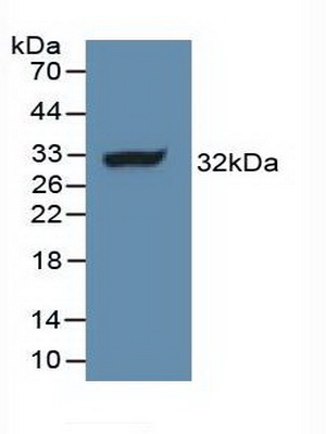 Polyclonal Antibody to PTEN Induced Putative Kinase 1 (PINK1)