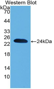 Polyclonal Antibody to Parkinson Disease Protein 7 (PARK7)