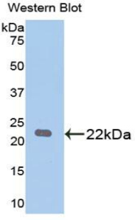 Polyclonal Antibody to Parkinson Disease Protein 7 (PARK7)