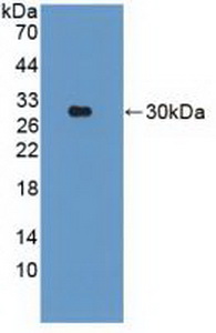 Polyclonal Antibody to Parkinson Disease Protein 2 (PARK2)
