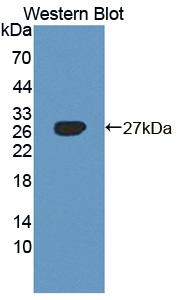 Polyclonal Antibody to AXL Receptor Tyrosine Kinase (AXL)