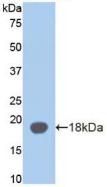 Polyclonal Antibody to Alpha-2-Glycoprotein 1, Zinc Binding (aZGP1)