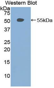 Polyclonal Antibody to Brother Of CDO Homolog (BOC)