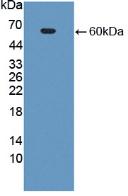 Polyclonal Antibody to Cat Eye Syndrome Chromosome Region, Candidate 1 (CECR1)