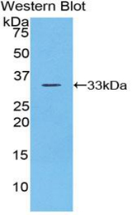 Polyclonal Antibody to Checkpoint Kinase 1 (CHEK1)