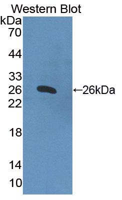 Polyclonal Antibody to Hermansky Pudlak Syndrome Protein 4 (HPS4)