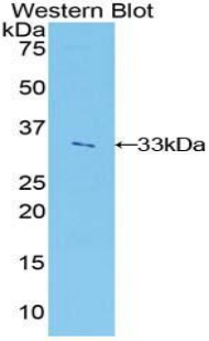 Polyclonal Antibody to Insulin Like Growth Factor 2 mRNA Binding Protein 2 (IGF2BP2)