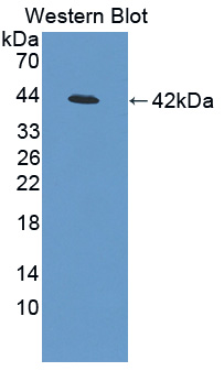 PAL617Hu01.jpg