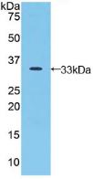 Polyclonal Antibody to Jagged 2 Protein (JAG2)