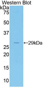 Polyclonal Antibody to Jagged 2 Protein (JAG2)