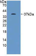 Polyclonal Antibody to Kelch Like ECH Associated Protein 1 (KEAP1)