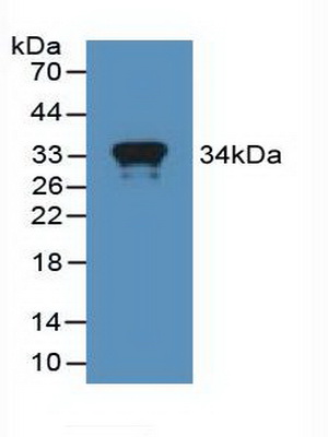 Polyclonal Antibody to Myxovirus Resistance 1 (MX1)