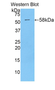 Polyclonal Antibody to Myxovirus Resistance 1 (MX1)