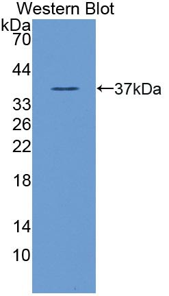 Polyclonal Antibody to N-myc Downstream Regulated Gene 2 (NDRG2)