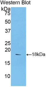 Polyclonal Antibody to Semaphorin 3A (SEMA3A)