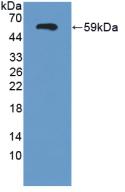 Polyclonal Antibody to Semaphorin 3E (SEMA3E)