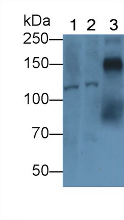 Polyclonal Antibody to Semaphorin 5B (SEMA5B)