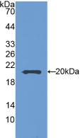 Polyclonal Antibody to Semaphorin 5B (SEMA5B)