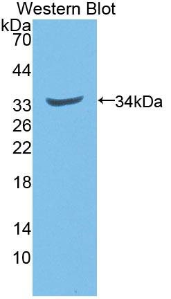 Polyclonal Antibody to NADH Dehydrogenase, Quinone 1 (NQO1)